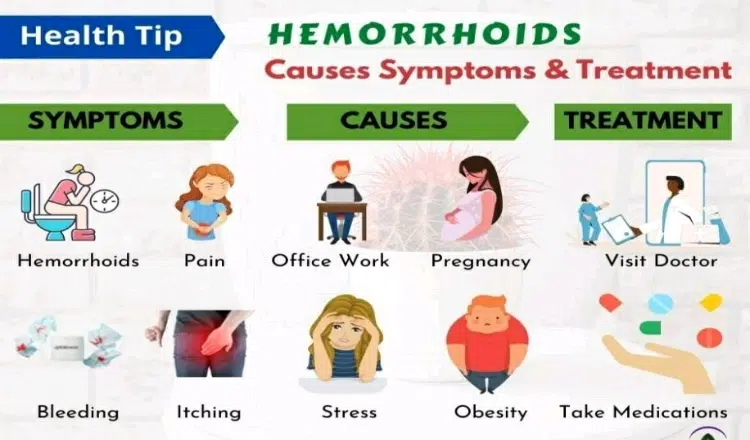 How to treat Hermorrhoids/Piles Naturally at home