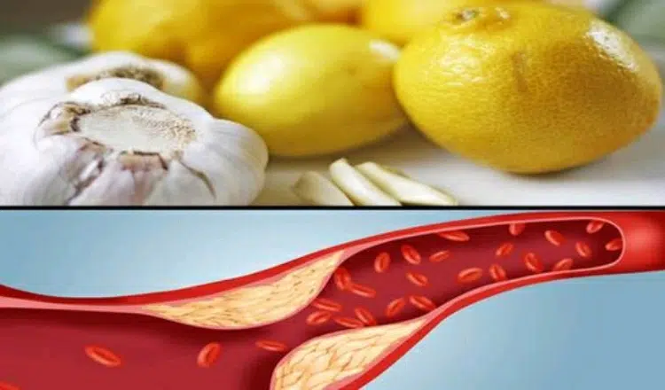 Garlic and Lemon to purify and thin the blood and other benefits