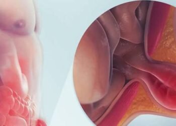 Natural Remedy for Hernia: Papaya Leaf, Ginger, Cloves, and Garlic Mixture