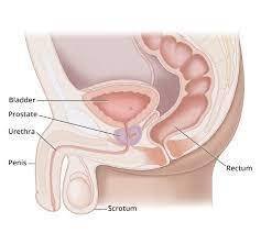 treatment of Prostate Cancer